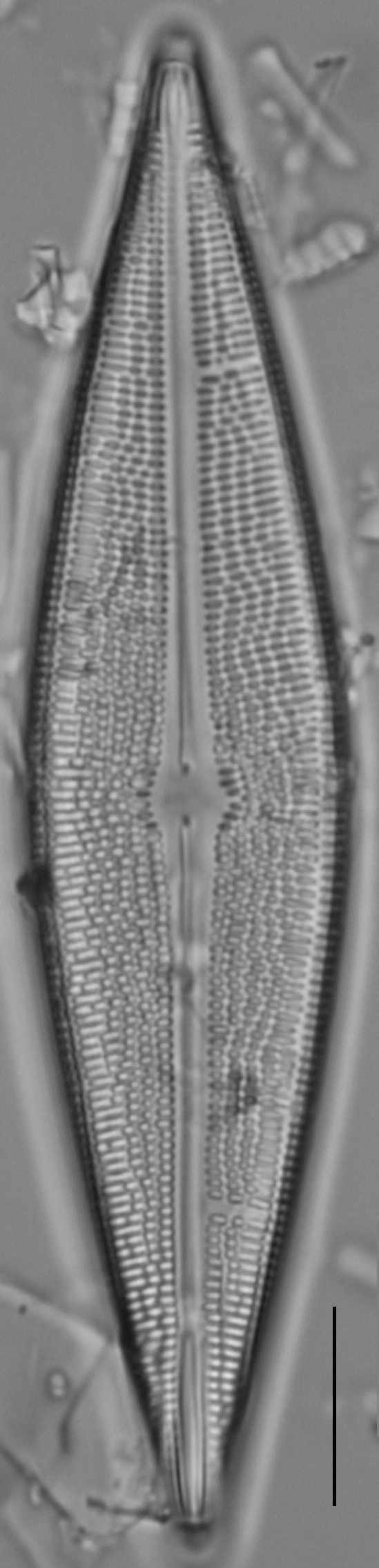 Brachysira serians LM2