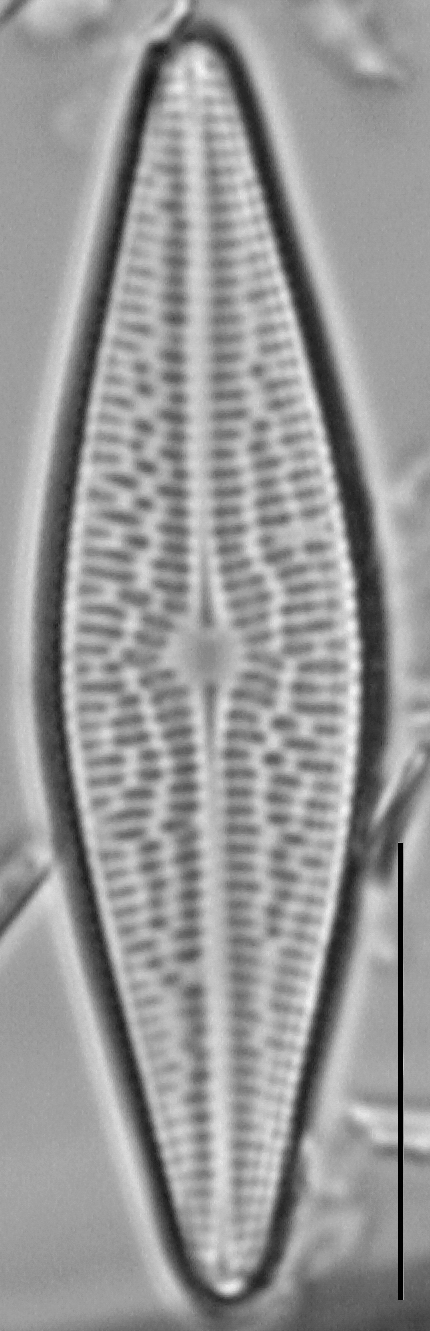 Brachysira brebissonii LM6