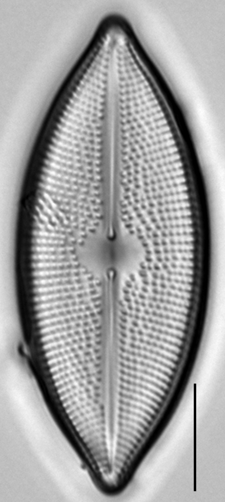 Lacustriella lacustris LM1