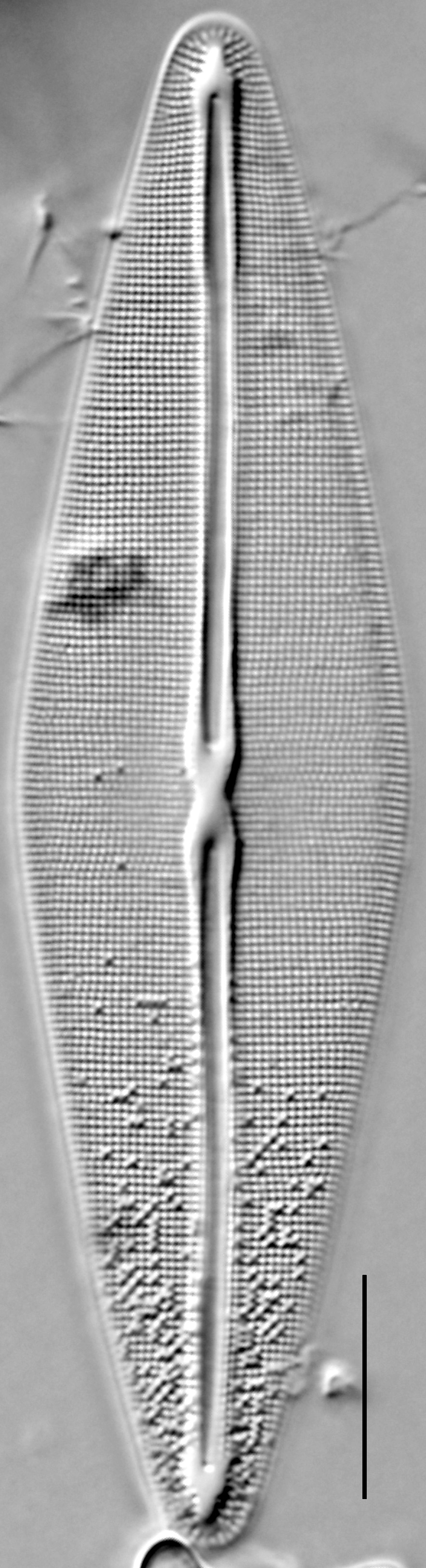 Frustulia rexii LM5