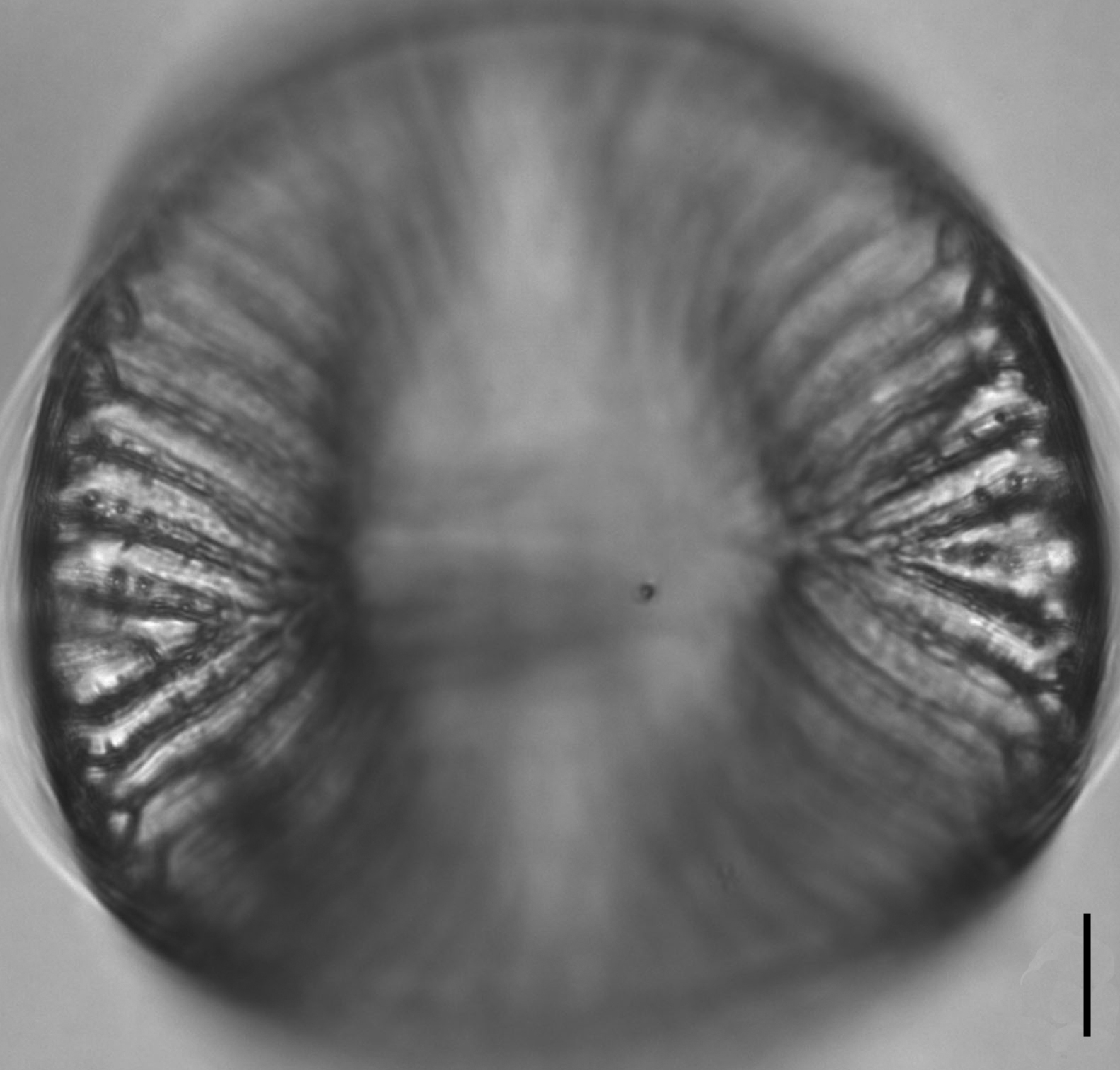 Campylodiscus4