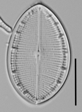 Cocconeis coreana LM1