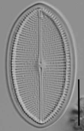 Cocconeis coreana LM2