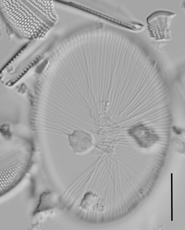 Cocconeis coreana auxospore