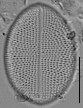 Cocconeis czarneckii LM3