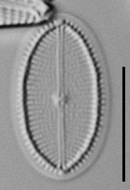 Cocconeis Neodiminuta Lm02