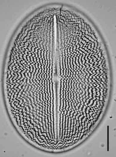 Cocconeis grovei LM5