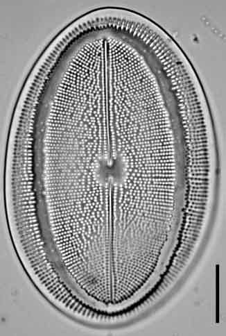 Cocconeis grovei LM2