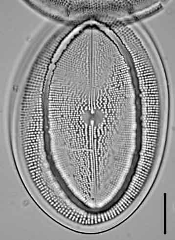 Cocconeis grovei LM3