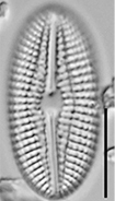 Diploneis abscondita LM7
