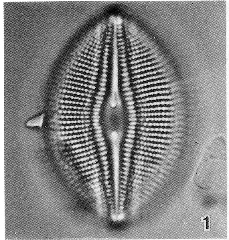 Diploneis Parma Lectotype