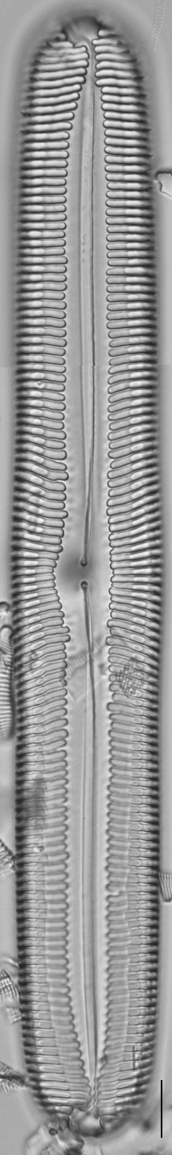 Pinnularia spinifera LM3