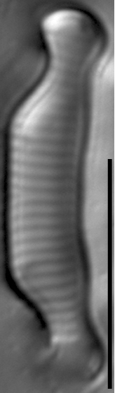 Eunotia orthohedra LM1