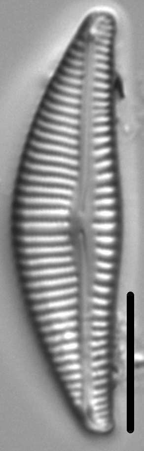 Encyonema lange-bertalotii LM1