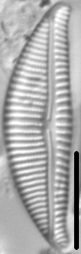 Encyonema lange-bertalotii LM2