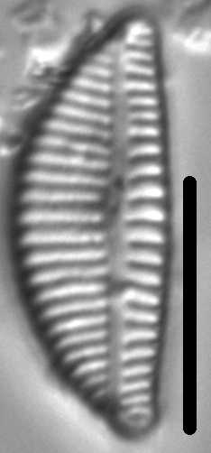 Encyonema lange-bertalotii LM6