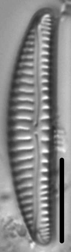 Encyonema paucistriatum LM5