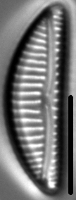 Encyonema procerum LM4