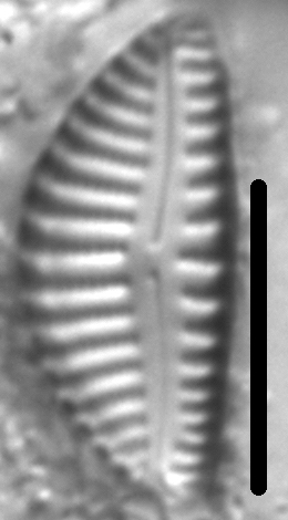 Encyonema montana LM6