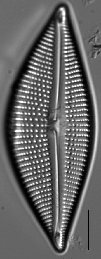 Encyonema triangulum LM2