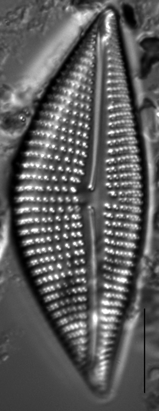 Encyonema triangulum LM5