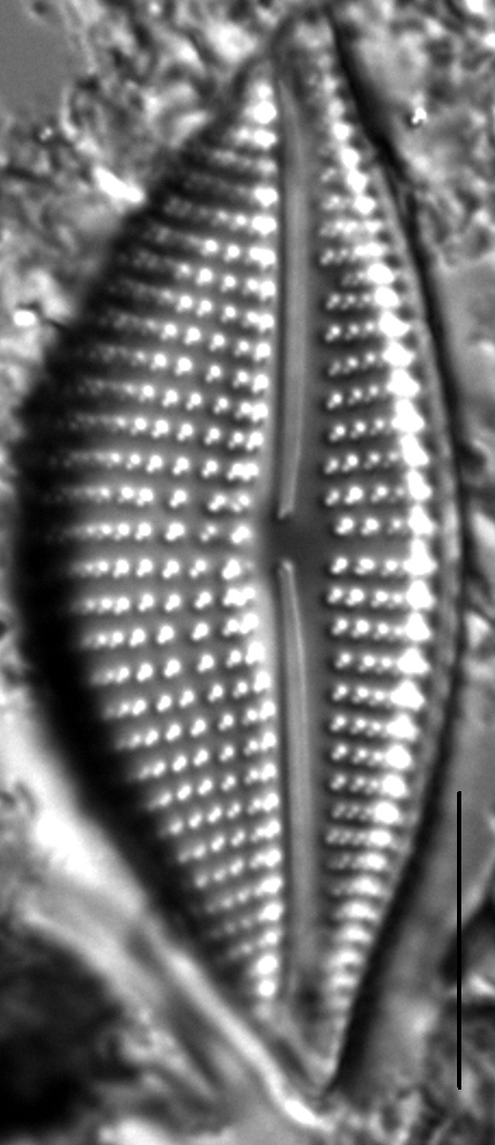 Encyonema triangulum LM7