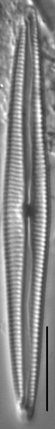 Encyonopsis Subspicula4