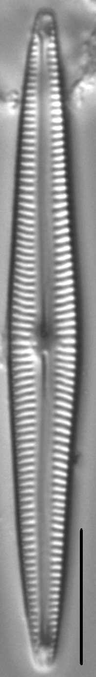 Encyonopsis Subspicula5