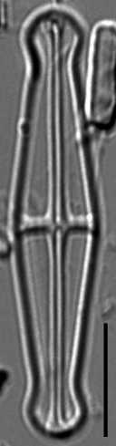 Envekadea pachycephala LM3