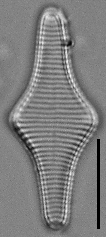 Fragilariforma polygonata LM5