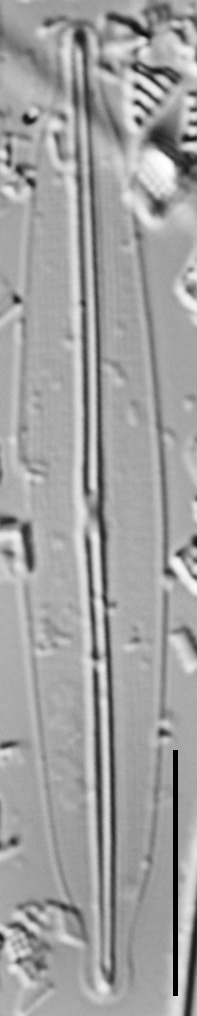 Frustulia pseudomagaliesmontana LM6