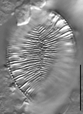 Surirella iowensis LM1