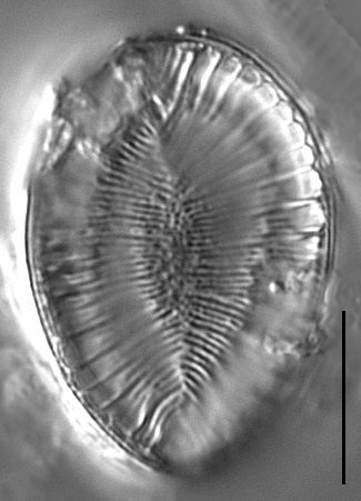 Surirella iowensis LM2