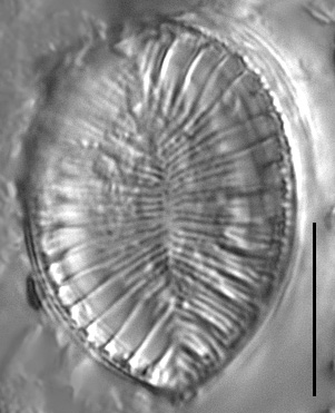 Surirella iowensis LM3