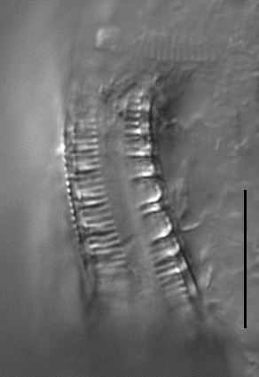 Surirella iowensis LM5