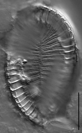 Surirella iowensis LM6