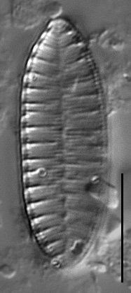 Surirella angusta LM2