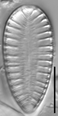 Surirella lacrimula LM6