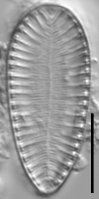 Surirella lacrimula LM5