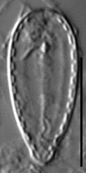 Surirella stalagma LM7