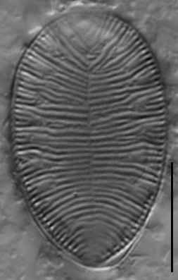 Gc112761A Brebissonii 3