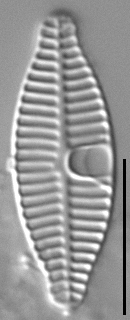 Planothidium incuriatum LM2