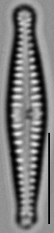 Gomphonema superiorense LM6