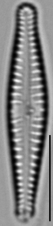 Gomphonema superiorense LM2