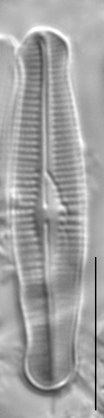 Achnanthidium duthiei LM3