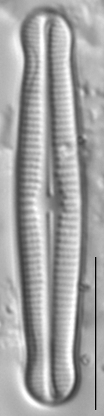 Achnanthidium duthiei LM6