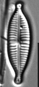 Gomphonema Lagenula LM7