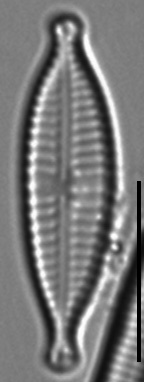 Gomphonema Lagenula LM6