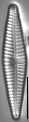 Gomphonema Bipunctatum 4 438001