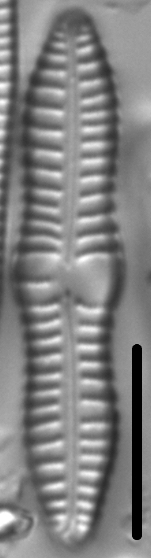 Gomphonema distans LM5